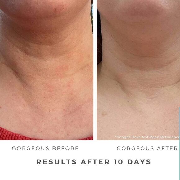 🌸HP🌸Earth Harbor Azure Regenerative Neck Cream! - Picture 5 of 8